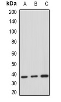 HDGF Rabbit Polyclonal Antibody