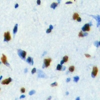 HDGF Rabbit Polyclonal Antibody