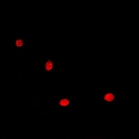 HDGF Rabbit Polyclonal Antibody
