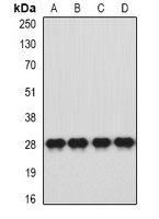 HLA-DQA1 Rabbit Polyclonal Antibody