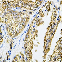 HLA-DQA1 Rabbit Polyclonal Antibody