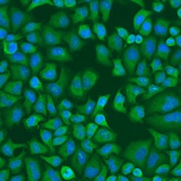 IGF2BP1 Antibody