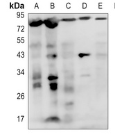 IL-1R1 Rabbit Polyclonal Antibody