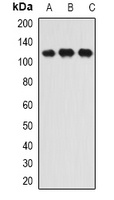 INTS6 Rabbit Polyclonal Antibody