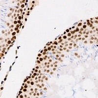 Importin alpha 1 Antibody