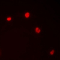 Importin alpha 1 Antibody