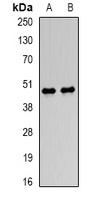Lumican Rabbit Polyclonal Antibody