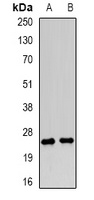 LY86 Rabbit Polyclonal Antibody