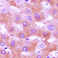 LY86 Rabbit Polyclonal Antibody