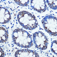 Monoamine Oxidase B Antibody