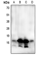 LC3A/B Rabbit Polyclonal Antibody