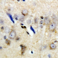 LC3A/B Rabbit Polyclonal Antibody