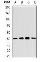 MKK5 Rabbit Polyclonal Antibody