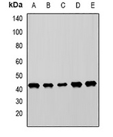 MICA Rabbit Polyclonal Antibody