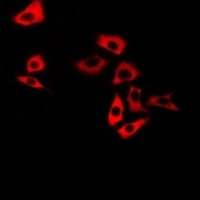 Calsarcin 1 Rabbit Polyclonal Antibody