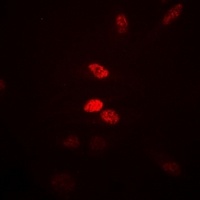 Visfatin Rabbit Polyclonal Antibody