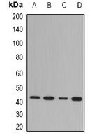 NDRG1 Rabbit Polyclonal Antibody