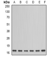 NDUFA12 Rabbit Polyclonal Antibody