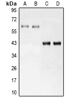 LRH-1 Rabbit Polyclonal Antibody
