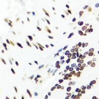 LRH-1 Rabbit Polyclonal Antibody