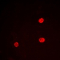 LRH-1 Rabbit Polyclonal Antibody