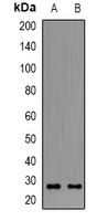 OLR1 Rabbit Polyclonal Antibody