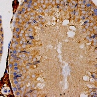 OLR1 Rabbit Polyclonal Antibody