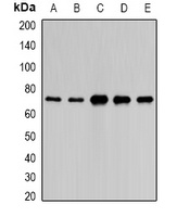 PAIP1 Rabbit Polyclonal Antibody