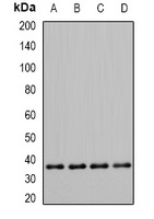 PDHB Rabbit Polyclonal Antibody