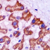 PEX5 Rabbit Polyclonal Antibody