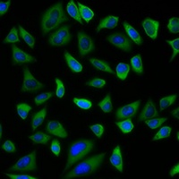 PEX5 Rabbit Polyclonal Antibody