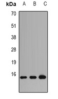 Profilin 1 Rabbit Polyclonal Antibody