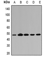 PGD Rabbit Polyclonal Antibody