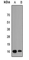 PLGF Rabbit Polyclonal Antibody
