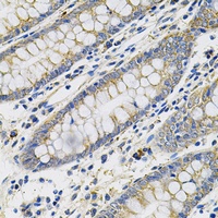 PLGF Rabbit Polyclonal Antibody