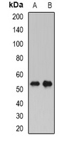 PLTP Rabbit Polyclonal Antibody