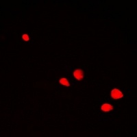 POLR2D Rabbit Polyclonal Antibody