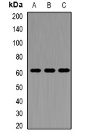 Perforin 1 Rabbit Polyclonal Antibody