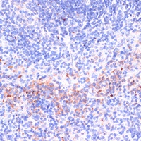 Perforin 1 Rabbit Polyclonal Antibody