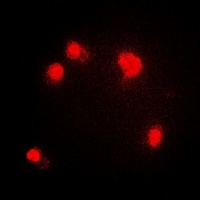 PRMT5 Rabbit Polyclonal Antibody