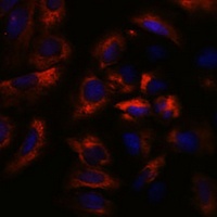 RAB27 Rabbit Polyclonal Antibody