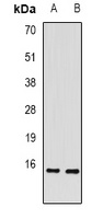 RBP2 Rabbit Polyclonal Antibody