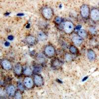 RBP2 Rabbit Polyclonal Antibody