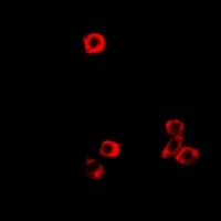 RBP2 Rabbit Polyclonal Antibody