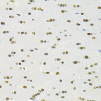 RBPJ Rabbit Polyclonal Antibody