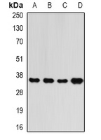 RFC5 Rabbit Polyclonal Antibody