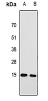 RPA3 Rabbit Polyclonal Antibody
