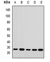 RPL14 Rabbit Polyclonal Antibody