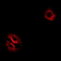 RPL14 Rabbit Polyclonal Antibody