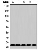 RPS5 Rabbit Polyclonal Antibody